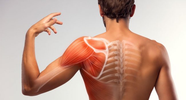 Bursita subacromiala